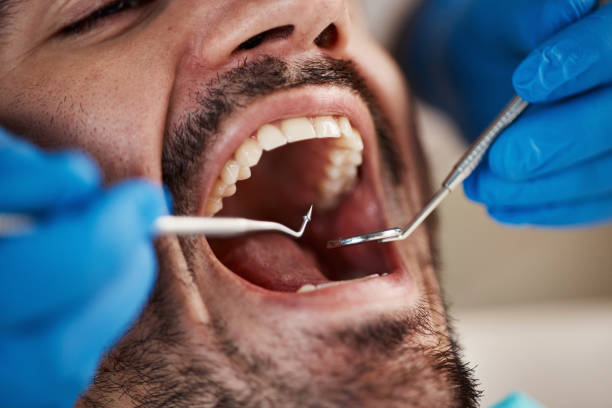 Best Emergency Treatment for Toothache in Lake Shastina, CA
